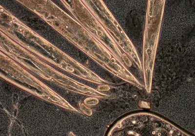 MUSCLE CONTROL: Researchers pinpoint how C. elegans (pictured) manages to expel food from its mouth. MUSCLE CONTROL: Researchers pinpoint how C. elegans (pictured) manages to expel food from its mouth.